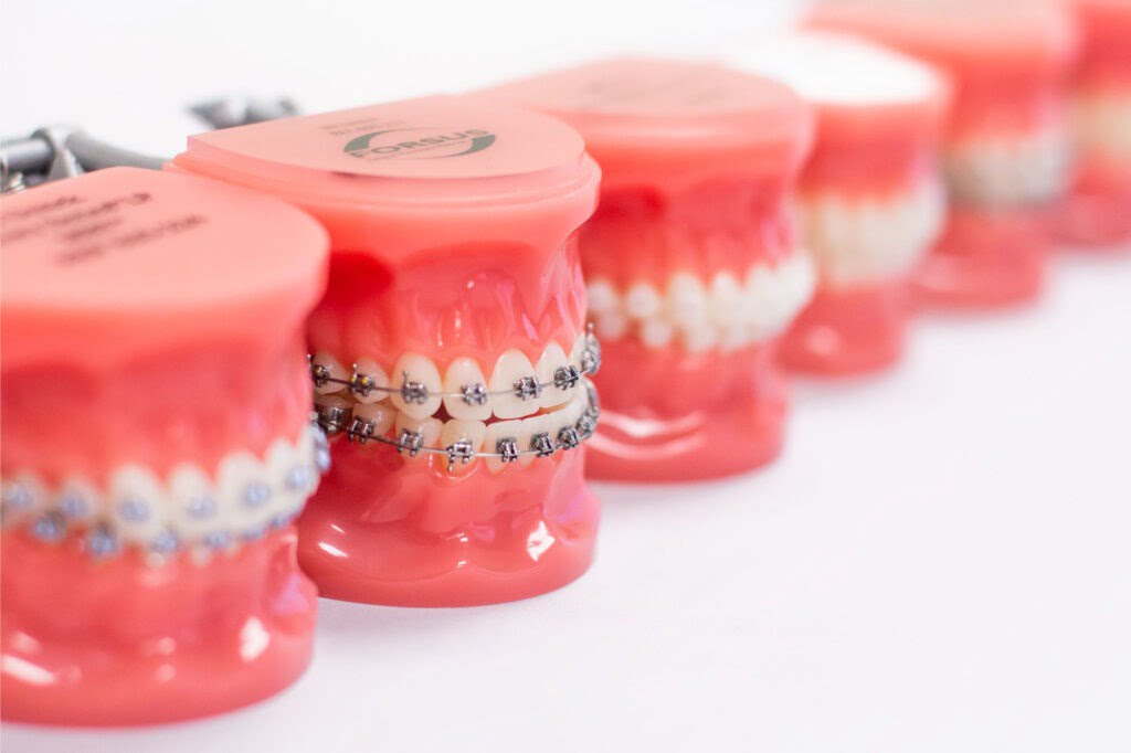 aparelho dentários porto alegre
