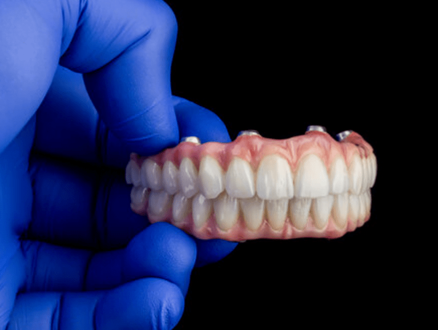protocolo sobre implantes
