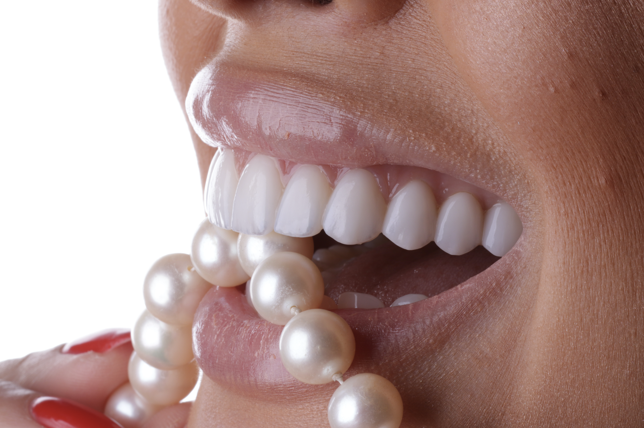 sorriso com lentes de porcelana protocolo borille com um colar de pérolas