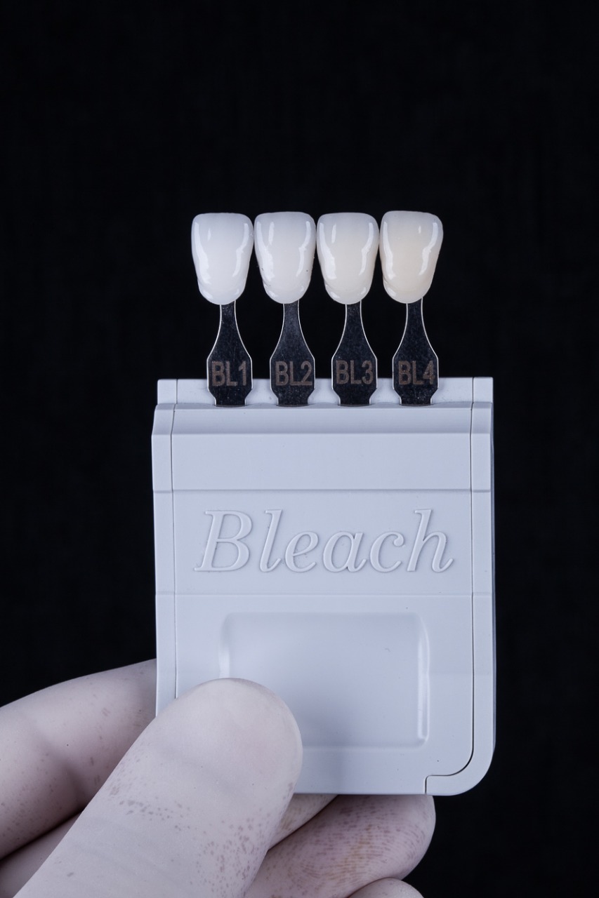 escala de cor para lente de contato dental em porto alegre